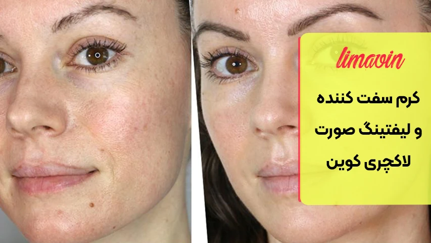 علت شل شدن و افتادگی پوست چیست؟
