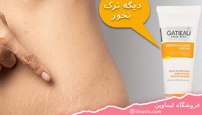 رفع ترک ناحیه های خاص بدن با کرم استرچ مارک گاتیو