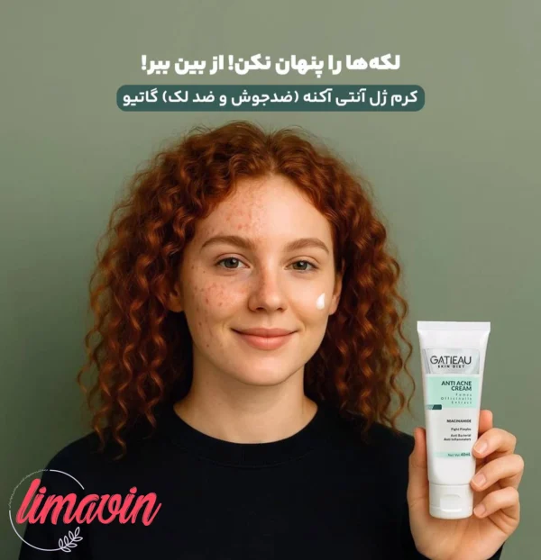 کرم ژل ضد لک (پماد نوروژن) گاتیو حجم ۴۰ میلی لیتر - Image 3