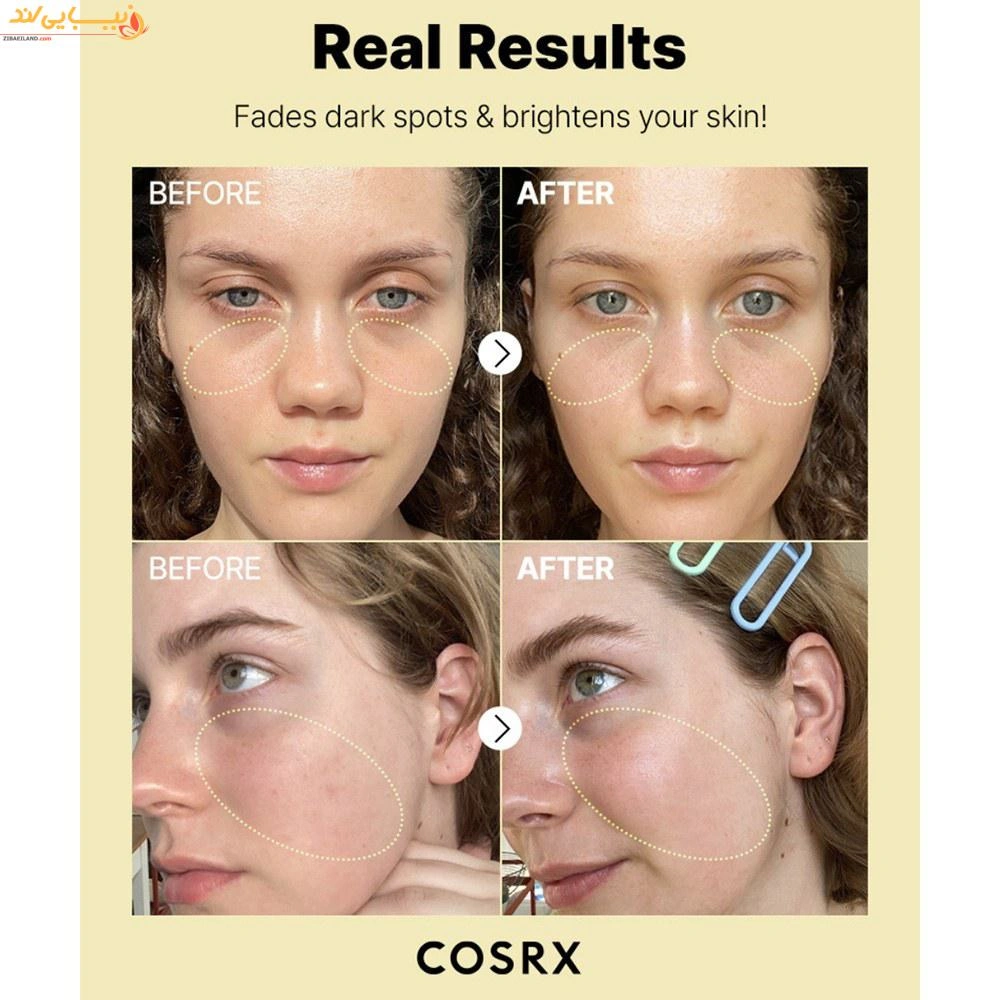 سرم ویتامین سی 23 درصد کوزارکس حجم 20 میلیلیتر