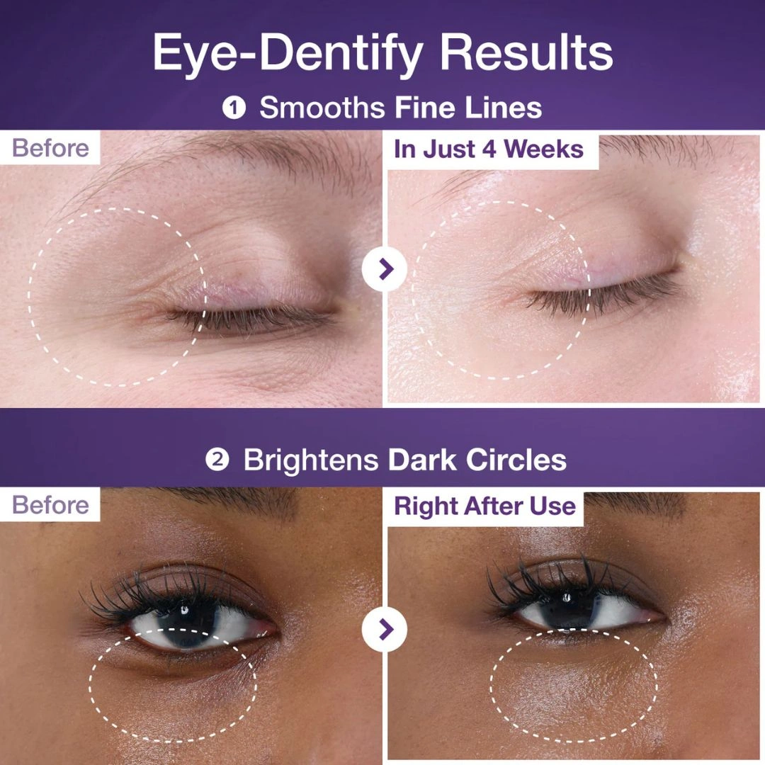 کرم دور چشم NAD+ و رتینول شماره ۹ نامبوزین