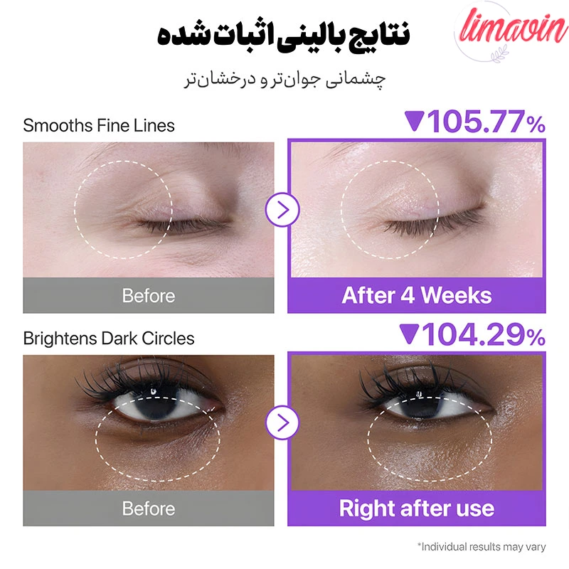 کرم-دور-چشم-لیفتینگ-نامبوزین-