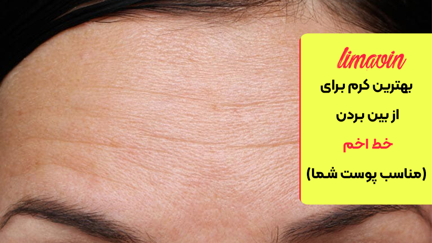 بهترین کرم برای از بین بردن خط اخم