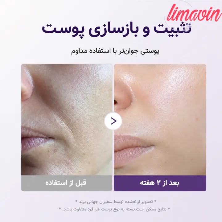 سرم بنفش مدی کیوب
