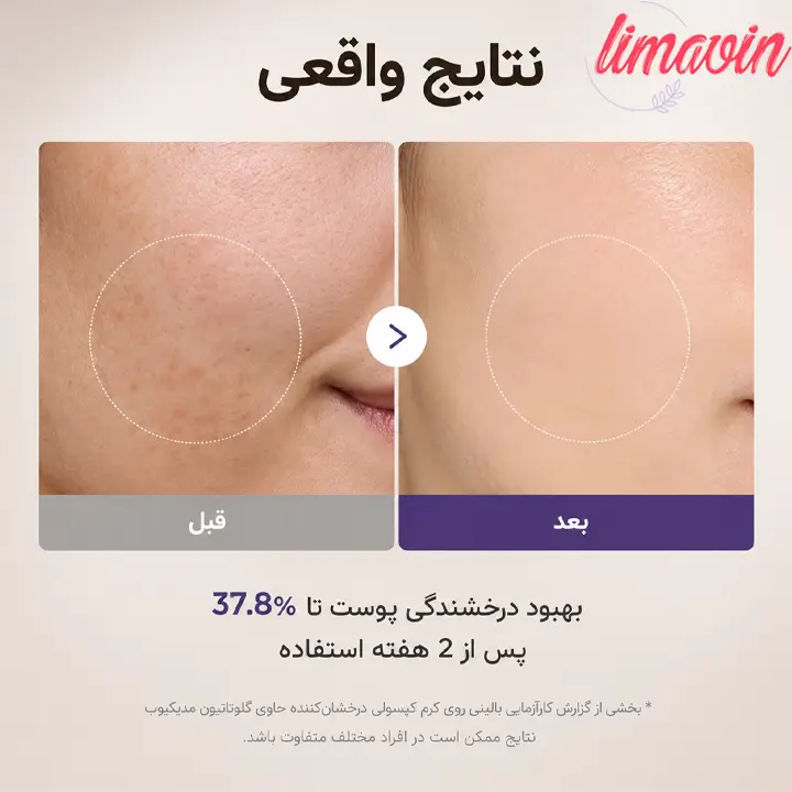 کرم کپسولی ایج ار مدی کیوب