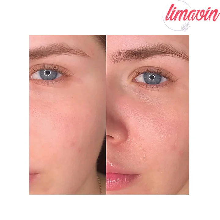 آمپول التیام بخش سنتلا ماداگاسکار اسکین 1004 - Image 4