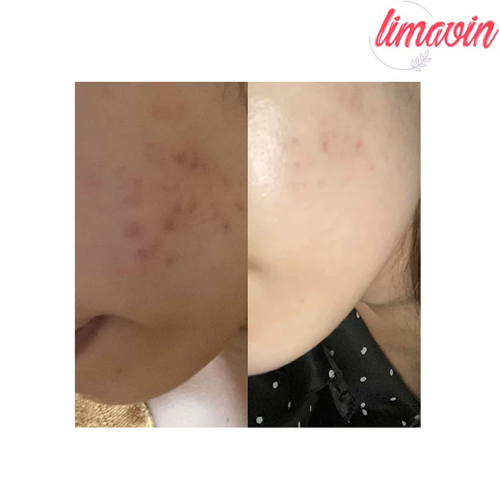 تونر لایه بردار و روشن کننده گلیکولیک اسید 7٪ اوردینری 240 میلی لیتر - Image 9