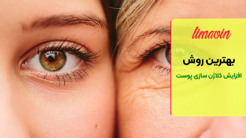 چه عواملی روند کاهش کلاژن را تسریع می کنند؟