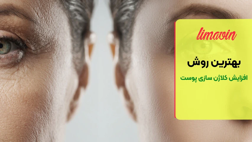 7 تا از بهترین روش های افزایش کلاژن سازی پوست