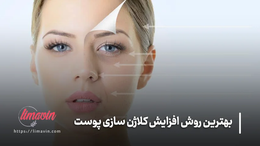 معرفی 8 محصول قوی برای افزایش کلاژن سازی پوست و لیفت طبیعی