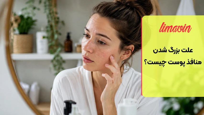 علت بزرگ شدن منافذ پوست چیست؟