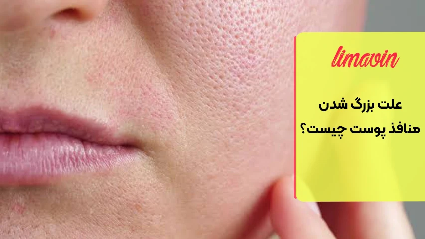 اشتباهات رایجی که منافذ پوست را بزرگ تر نشان می دهند