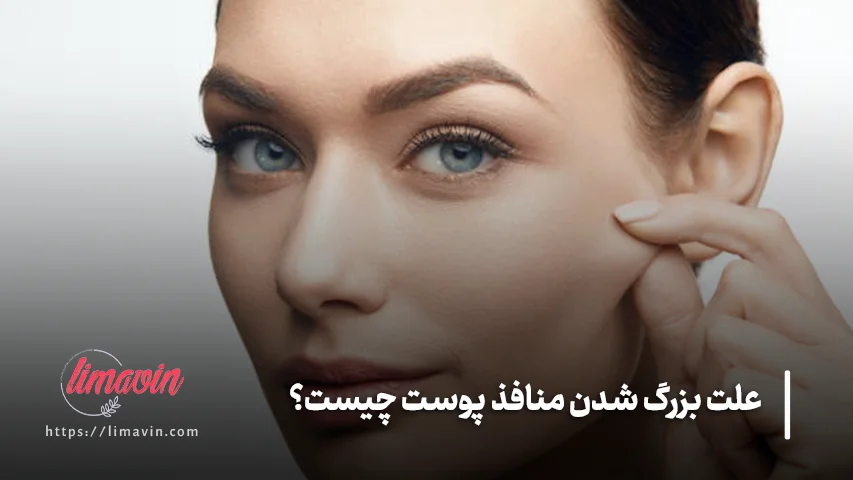 بهترین مواد مؤثر برای کاهش منافذ باز پوست