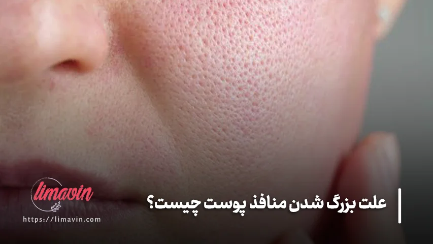 آیا محصولات مراقبت از پوست می توانند منافذ را کوچک کنند؟