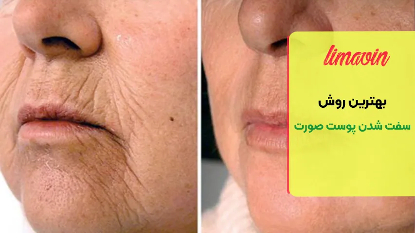 روش های خانگی برای سفت شدن پوست صورت