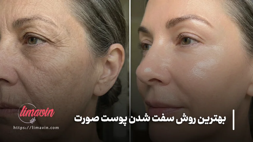 معرفی بهترین روش سفت شدن پوست صورت
