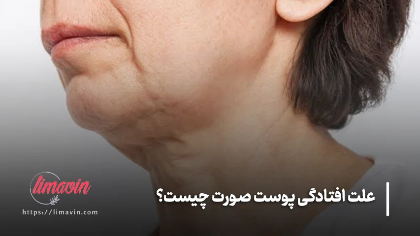بهترین روش درمان افتادگی پوست صورت چیست؟