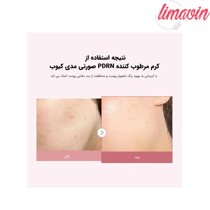 کرم مرطوب کننده هیالورونیک و PDRN مدی کیوب حجم 50 میلی لیتر - تصویر 2