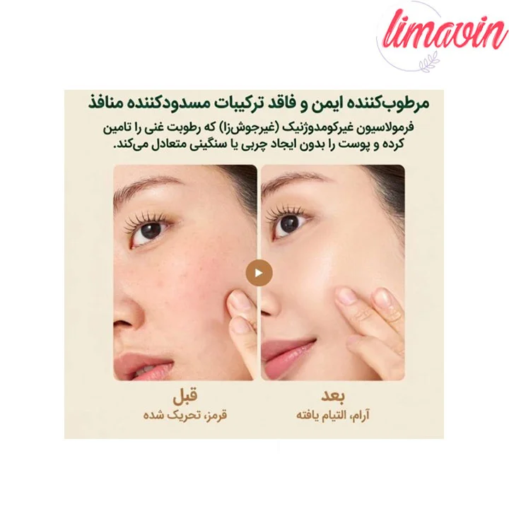 ژل کرم تسکین دهنده جو دوسر پیوریتو حجم 100 میلی لیتر - Image 4