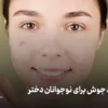 کرم ضد جوش برای نوجوانان دختر