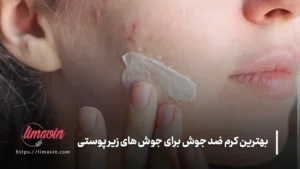 بهترین کرم ضد جوش برای جوش های زیر پوستی
