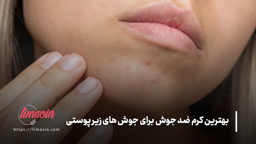 ترکیبات بهترین کرم ضد جوش برای جوش های زیر پوستی