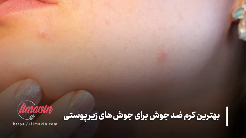 چه محصولاتی برای جوش های زیر پوستی مناسب نیستند؟