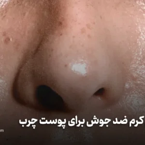 بهترین کرم ضد جوش برای پوست چرب