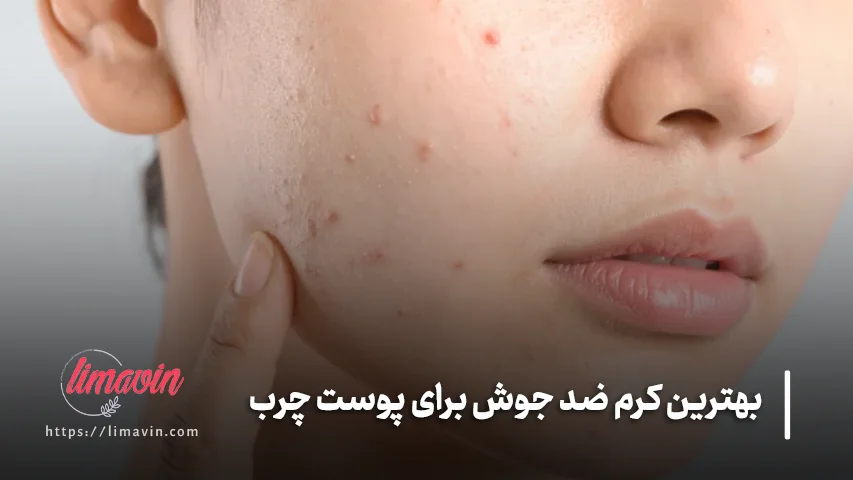 بهترین ترکیبات ضد جوش برای پوست چرب