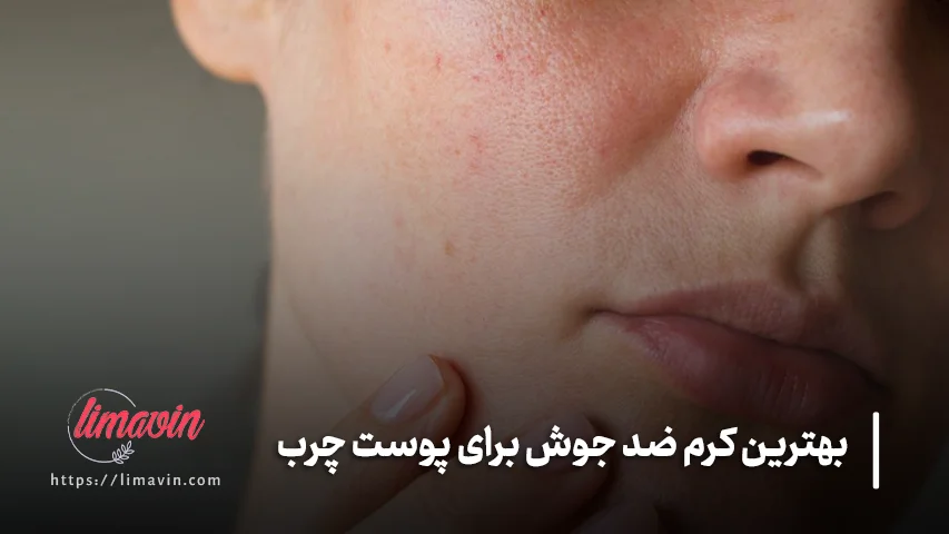 کرم ضد جوش را با چه محصولاتی نباید همزمان استفاده کرد؟