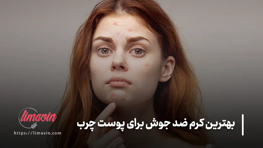 5 کرم ضد جوش مناسب برای پوست چرب