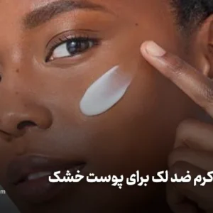 بهترین کرم ضد لک برای پوست خشک