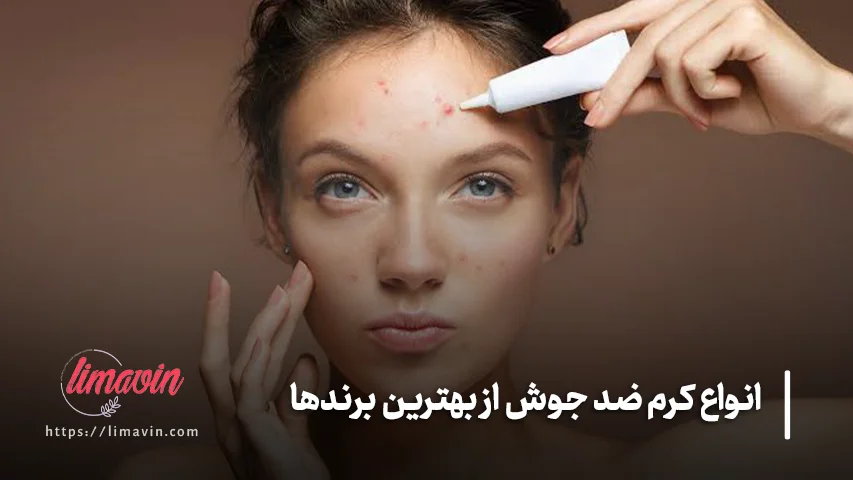 انواع کرم ضد جوش از بهترین برندها
