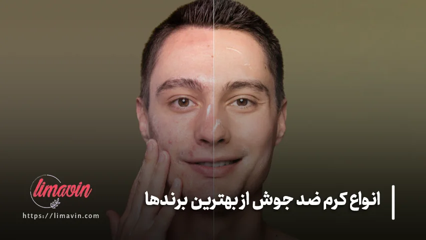 تفاوت کرم ضد جوش برای جوش های سرسیاه، زیرپوستی و التهابی